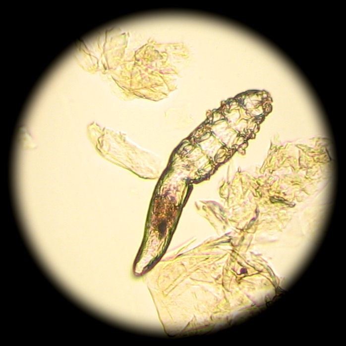 Παράσιτο Demodex στο Ηλεκτρ. Μικροσκόπιο